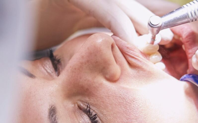 Soin des caries à Argelès-sur-Mer : découvrez les traitements avancés du Dr Éléonore Fournel